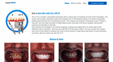 allon4implants.dental