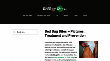 bedbugsbites.net