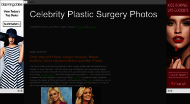 celebrityplasticsurgerypics.blogspot.com