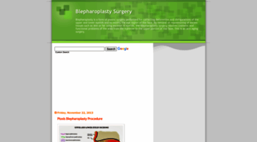 blepharoplasty-magic.blogspot.com