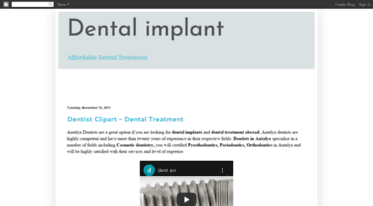 dentalimplanttry.blogspot.com