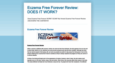 eczema-free-forever-review.blogspot.com
