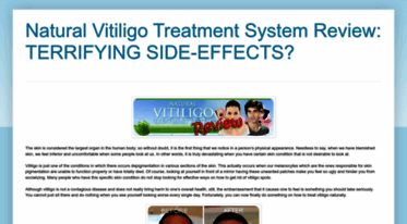 naturalvitiligotreatmentsystems.blogspot.com