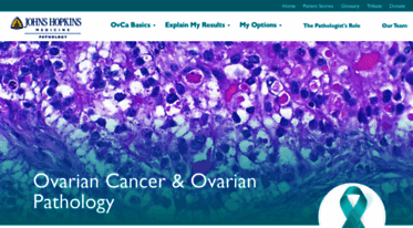 ovariancancer.jhmi.edu