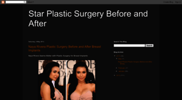 starplasticsurgery.blogspot.com